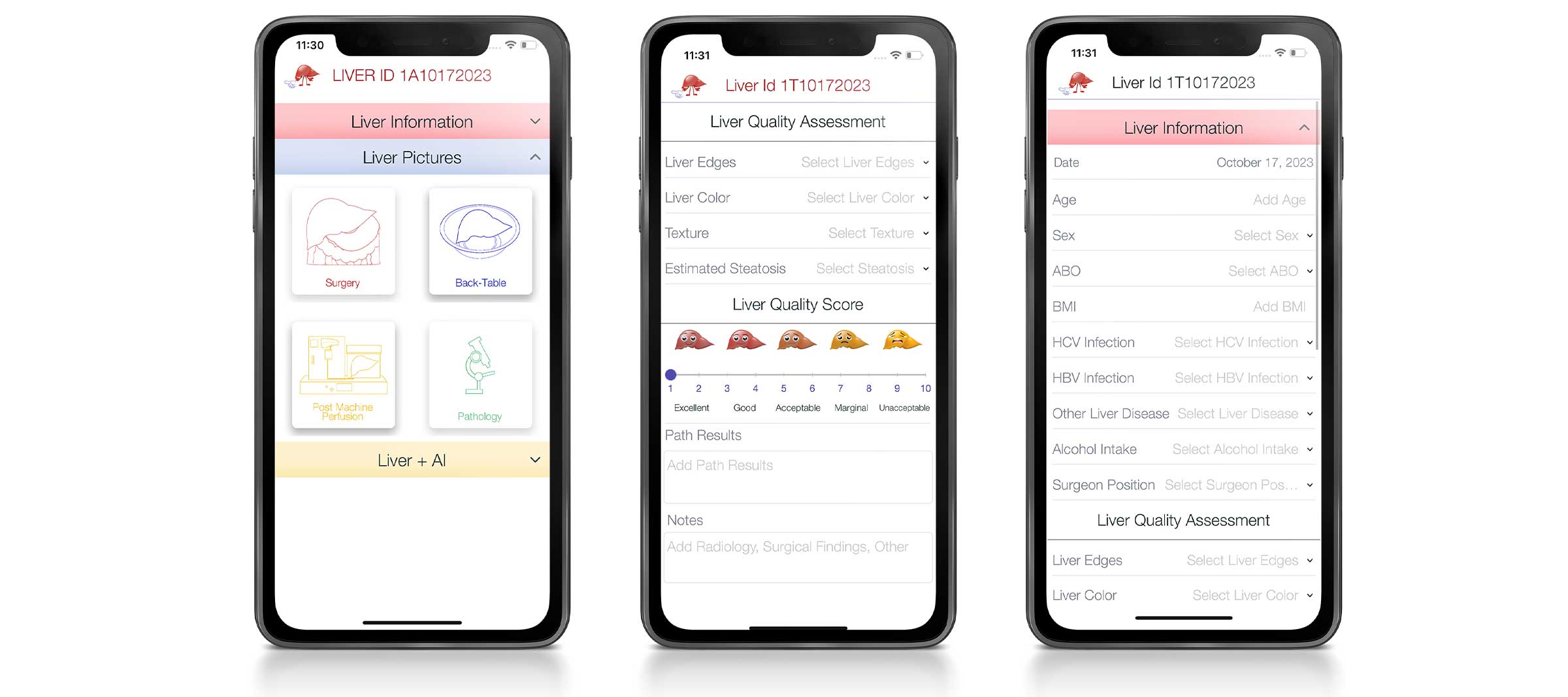 web-gfx-portfolio-2400x-liver-ai-01 svg+xml;charset=utf