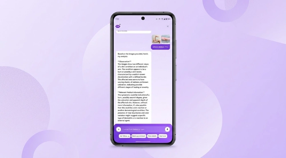 AI-Powered Medical Image Analysis