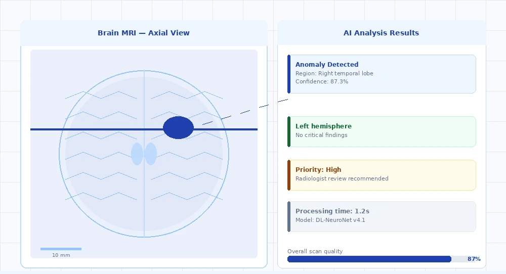AI MRI scan analysis