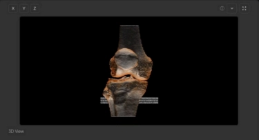 3D Volume View